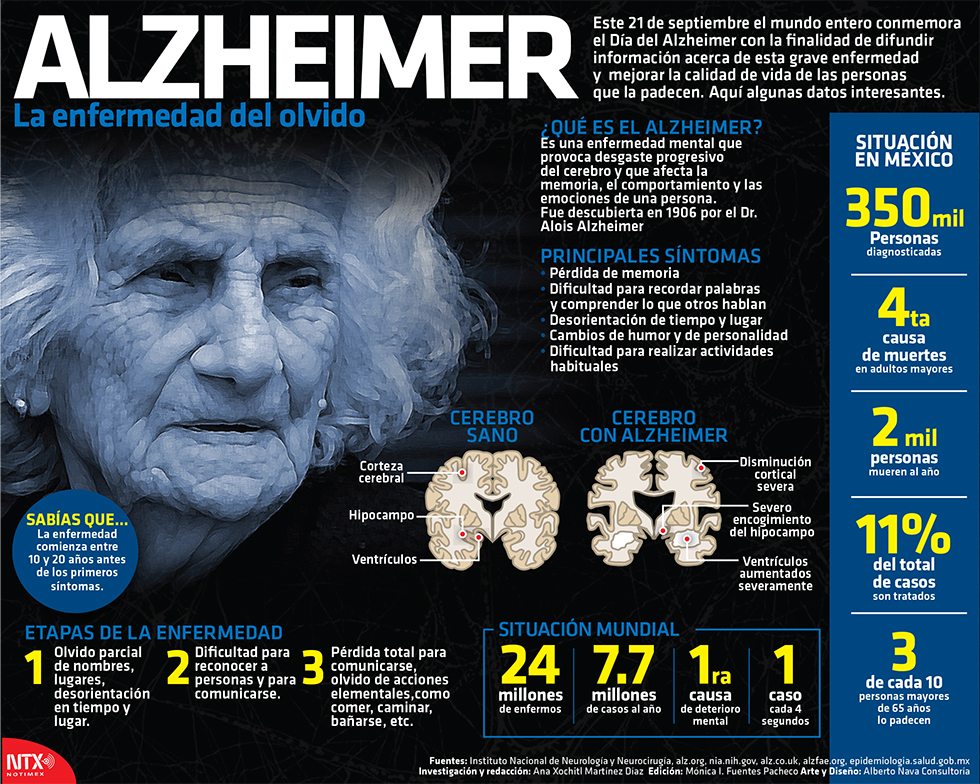 Alzheimer y perdida de peso